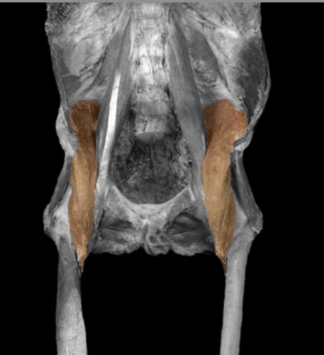 Spotter Myology Of Lower Limb Flashcards Quizlet