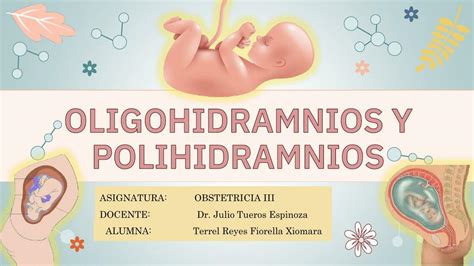 Oligohidramnios Y Polihidramnios Fioxio Terey Udocz