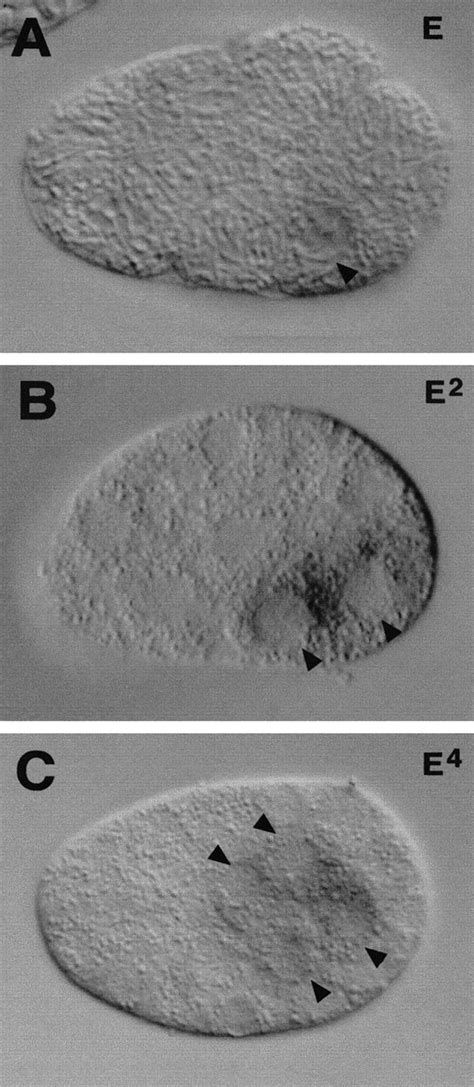 End Encodes An Apparent Gata Factor That Specifies The Endoderm