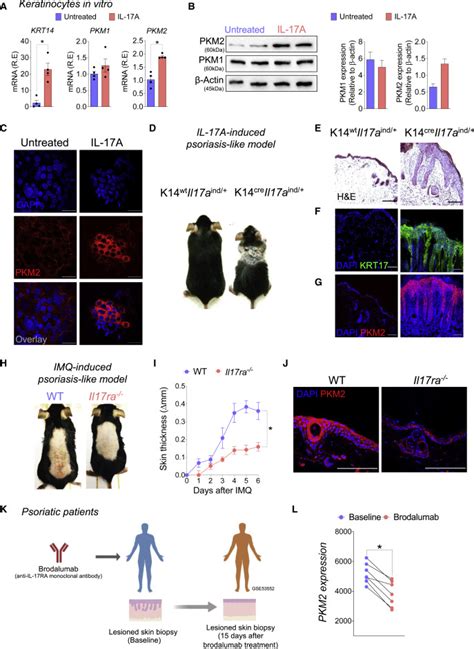 Pyruvate Kinase M Mediates Il Signaling In Keratinocytes Driving