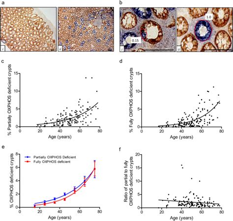 Predominant Asymmetrical Stem Cell Fate Outcome Limits The Rate Of