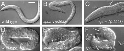 Spon Mutants Are Defective In Epidermal Morphogenesis And Muscle