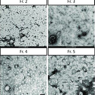 Transmission Electron Microscopy Tem Characterization Fractions To