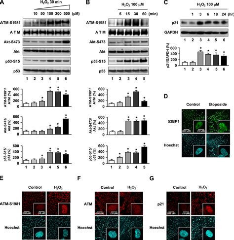 Oxidative Stress Induces Atm S1981 Akt S473 P53 S15 Phosphorylation