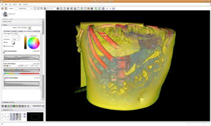 Modules Volumerendering Documentation Slicer Wiki