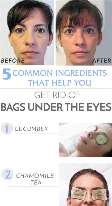 How To Get Rid Of Under The Eye Bags At Home Girls Beauty Charm Eye