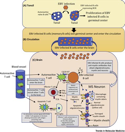 Epstein Barr Virus In Multiple Sclerosis Theory And Emerging Immunotherapies Trends In