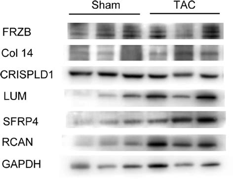 Western Blotting Tests Representing Protein Levels Of Hub Genes FRZB