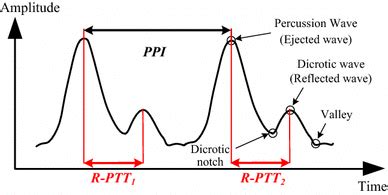 Typical PPG Waveforms With Reflected Pulse Transit Times R PTT