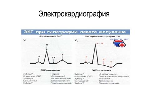 Митральные стенозы - презентация онлайн