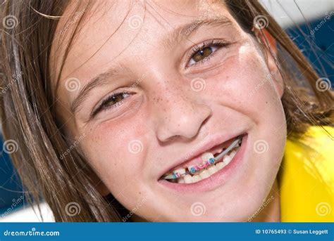 Cute Girls Braces Telegraph