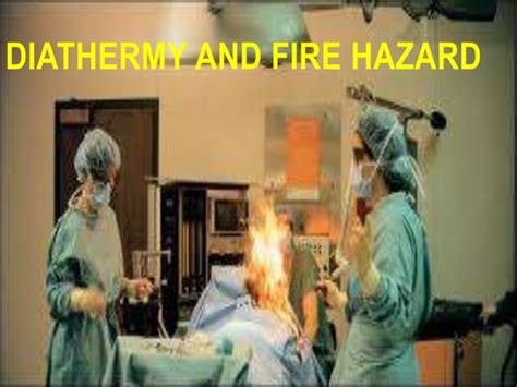 Diathermy And Fire Hazard In Operating Theatre PPT