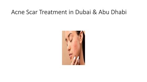 Ppt Acne Scar Treatment In Dubai And Abu Dhabi Powerpoint Presentation