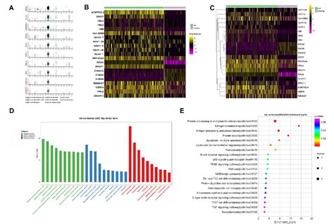 Figure 2 From Single Cell Rna Seq Of Bone Marrow Cells In Aplastic