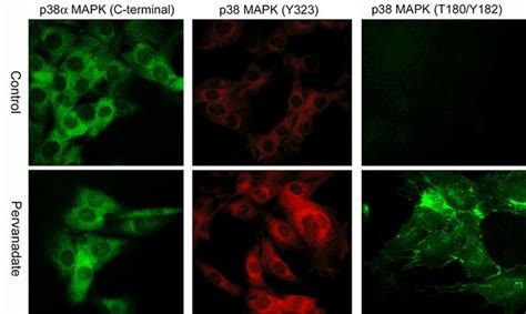 ECM Bioscience P38 MAPK Phospho Regulation Immunocytochemistry Kit ECM