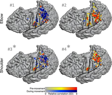 Spatiotemporal patterns of cortical activity linked to muscle ... 