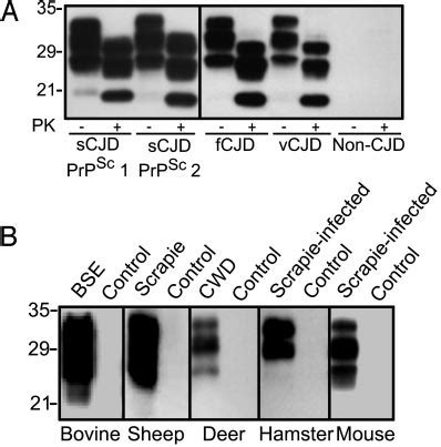 Ocd Captures Disease Associated Prp Sc From Various Prion Infected