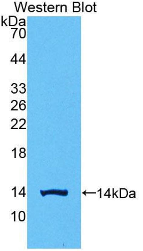 hCG beta 1 Polyclonal Antibody Invitrogen 20 μL Unconjugated