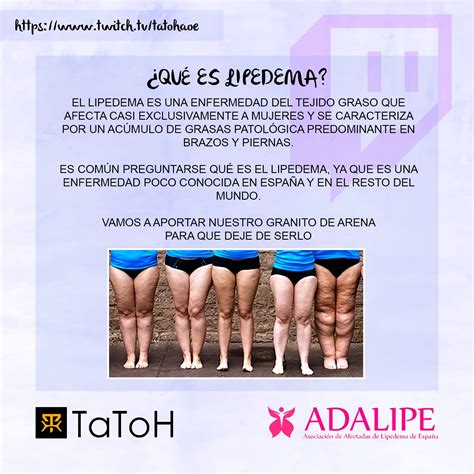 Evento TaToH en colaboracion con ADALIPE Asociación de Afectadas de