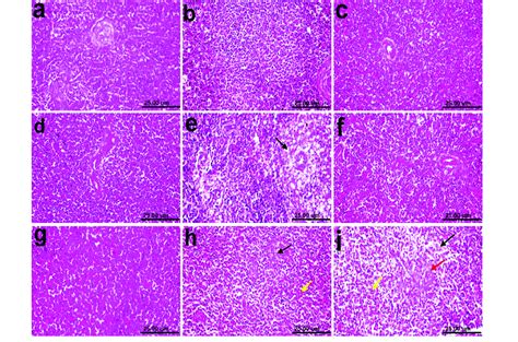 Photomicrographs Of Histological H E Stained Spleen Sections Of