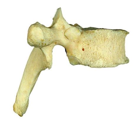 Thoracic Vertebrae Right Lateral View Diagram Quizlet