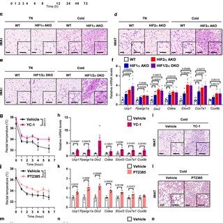 Adipocyte Specific Hif Ko Mice Exhibit Increased Thermogenic