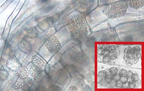 小麦縞萎縮病の発生について アグリポートWeb