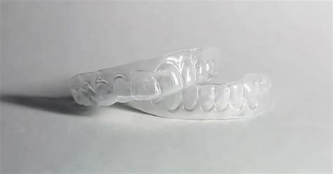 Replacement Retainer: The Cost and Where to Get One in the UK?