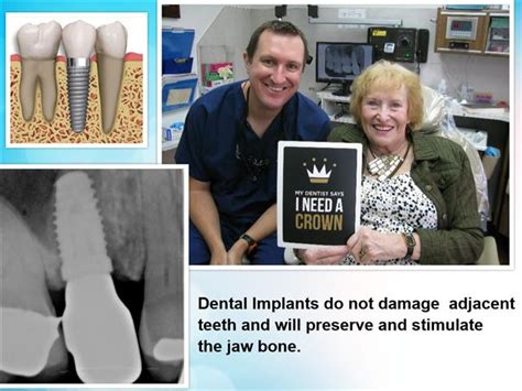 Dental Implant Bridge Dr Nugent Pasadena Implant Dentist