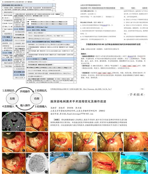 齐鲁医院神经外科李卫国教授团队顺利开展dbs日间加速康复外科手术治疗帕金森病 脑医汇 神外资讯 神介资讯