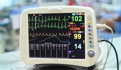 Pantalla De Electrocardiograma Monitoreo Card Aco Esencial La Pantalla