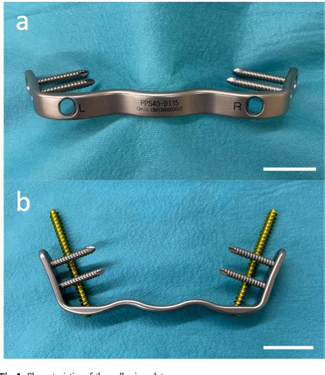 Figure From Minimally Invasive Transiliac Anatomical Locking Plate