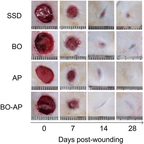 The Photographs Showing The Appearance Of The Burn Wounds At The Th