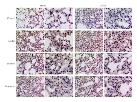 Expression Of Nf κb P65 Protein In Lung Tissues Of Mice In Each Group