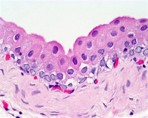 Urinary Bladder Histology