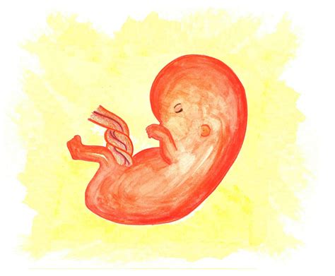 El Aborto