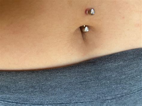 Is this an irritation bump? I’ve had it for a few months now and not