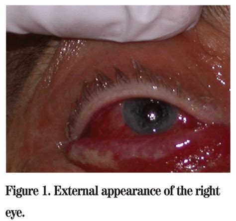 Wills Eye Resident Case Series