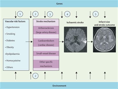 Genetics Of Ischaemic Stroke The Lancet Neurology