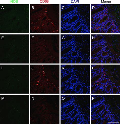 Double Immunofluorescent Staining Of Macrophages Using Two Mouse Download Scientific Diagram