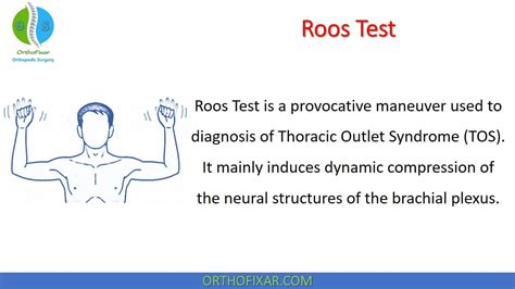 Roos Test Roos Test Is A Provocative Maneuver Used To Diagnosis Of Thoracic Outlet Syndrome Tos