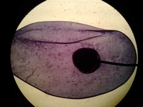 Parasitology Flashcards Quizlet