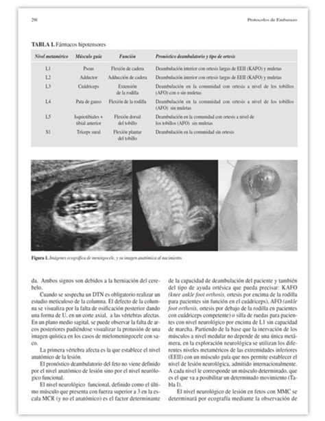 Protocolos De Medicina Materno Fetal Perinatolog A Edici N Ergon