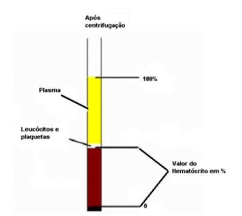 Hematócrito Alto ou Baixo Quais as Causas Hemograma Exame de Sangue