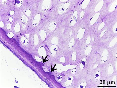 Cartilage Template Exhibited Typical Zonal Organization Of The Growth