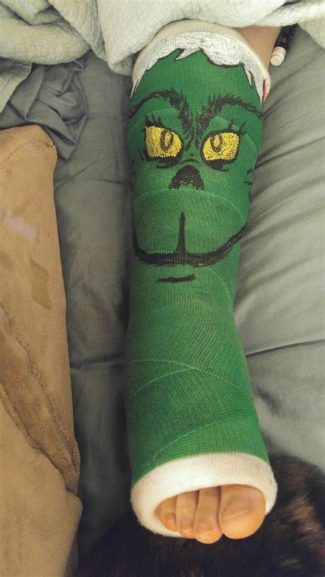 The Grinch Leg Cast Leg Cast Cast Decoration Arm Cast