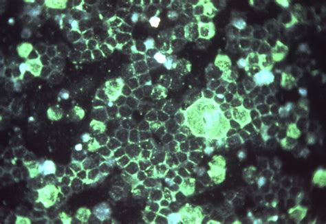 An ‘unprecedented Rise In Respiratory Viruses In Children Is