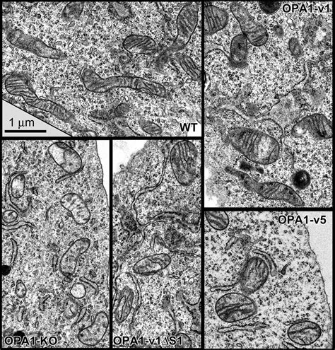 The Short Variant Of The Mitochondrial Dynamin Opa1 Maintains