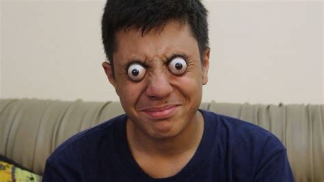 Bizarre Teen Can Pop Eyes Out For One Minute Youtube