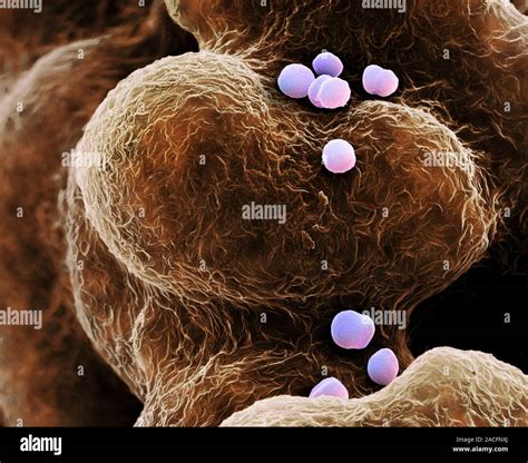 Mrsa Bacteria Coloured Scanning Electron Micrograph Sem Methicillin